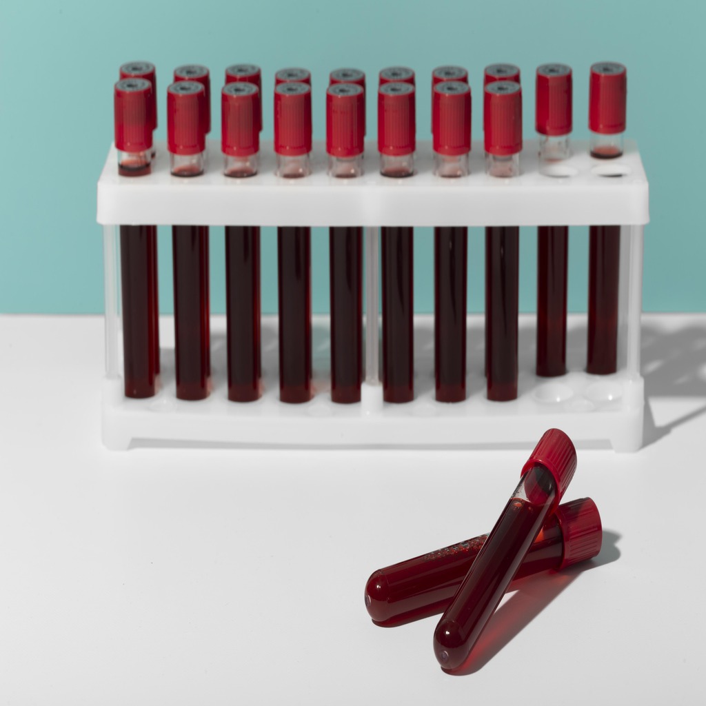 Blood samples image